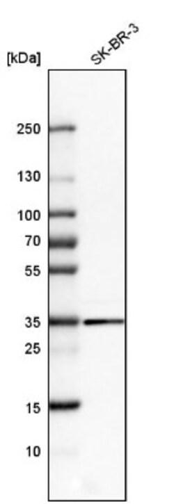 Galectin-8 Antibody, Novus Biologicals 0.1mL; Unlabeled:Antibodies, Polyclonal